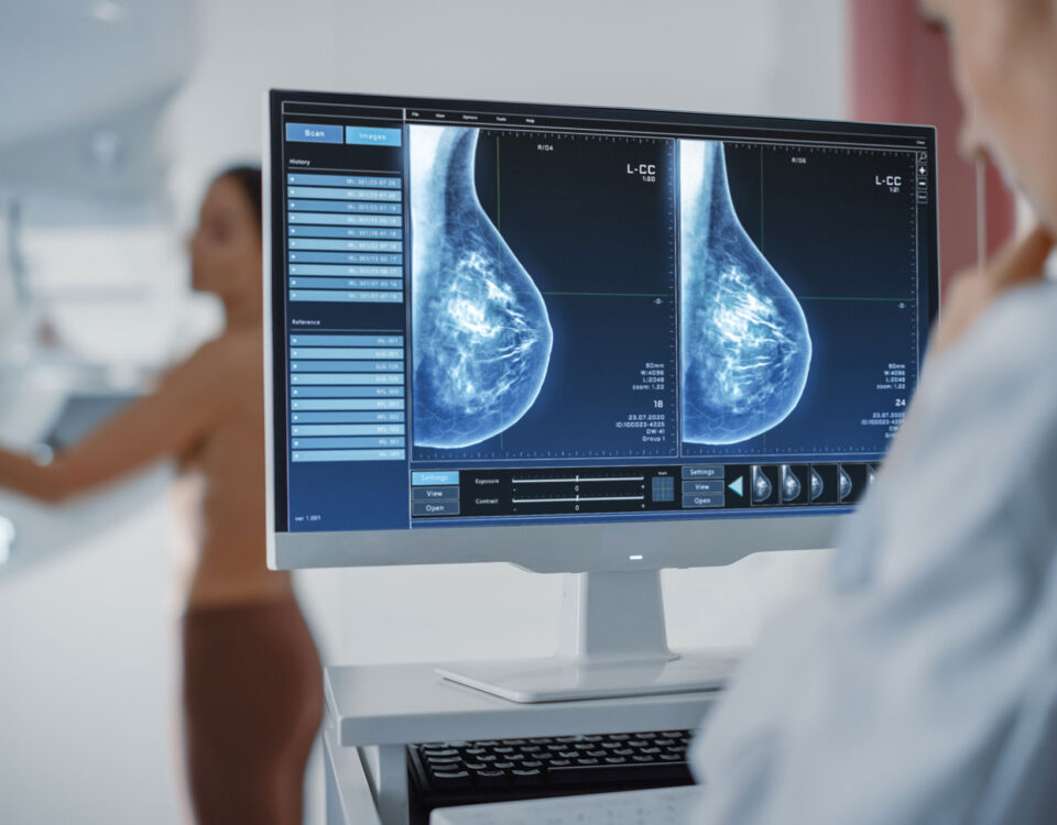 Breast Digital Mamogram