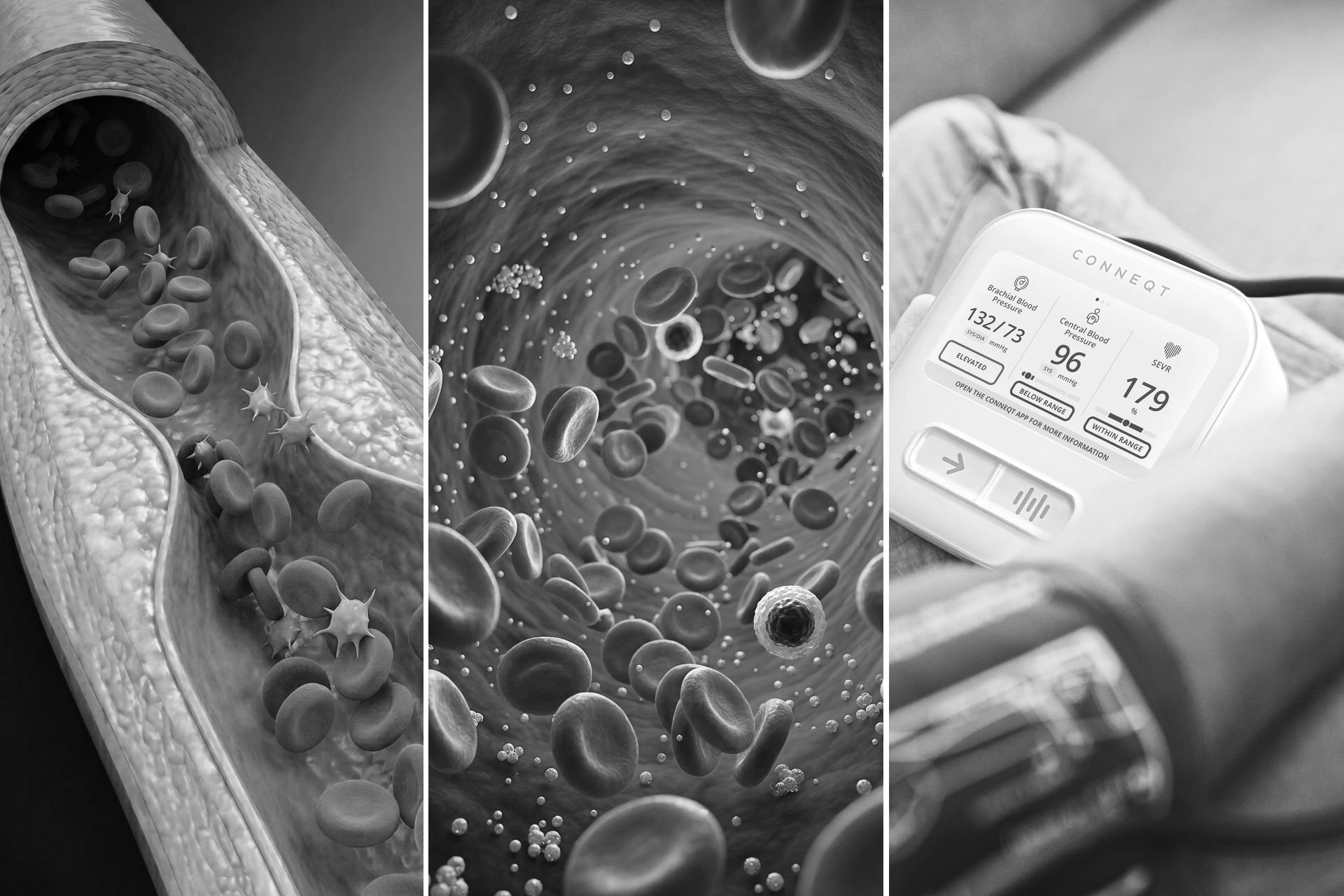 Three ways to look at your arteries: structure, flow, and function.