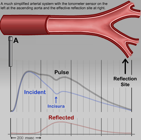 Central Pressure Waveform Animations