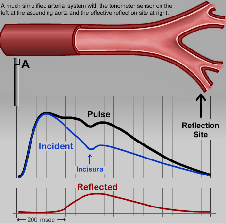 Central Pressure Waveform Animations